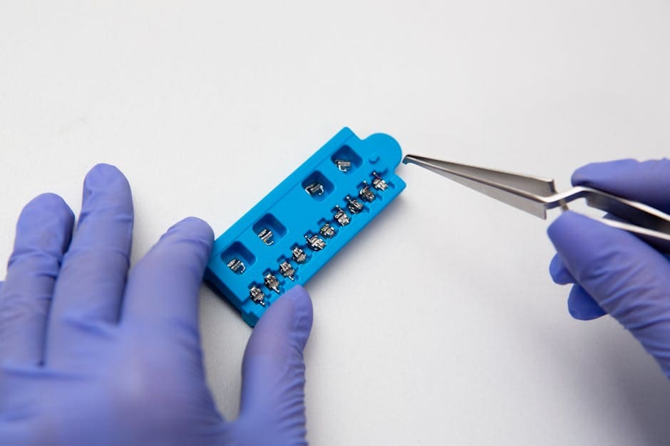 Hands of dentist in lilac latex medical gloves with dental tweezers and set of metal brace system